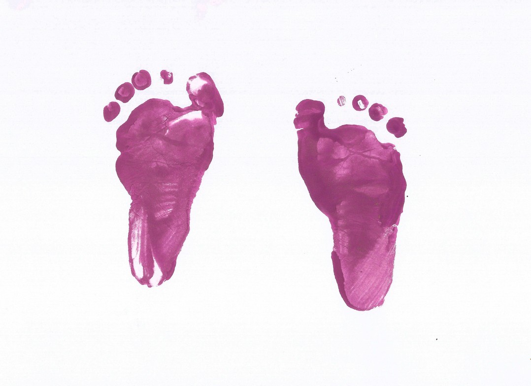 Safe pregnancy acupuncture session in Evanston with licensed acupuncturist, using prenatal-safe points for comfort and relaxation.