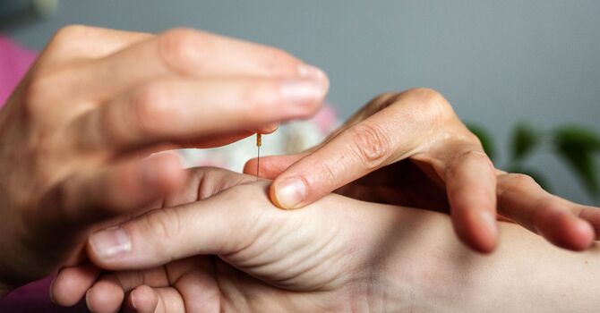 Feeling Stuck? How Acupuncture in Evanston Can Help You Find Clarity and Momentum