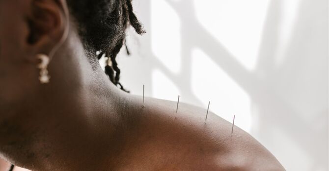 Feeling Stuck? How Acupuncture in Evanston Can Help You Find Clarity and Momentum