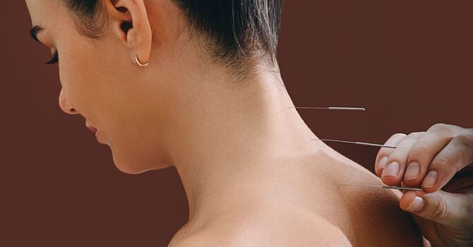 Feeling Stuck? How Acupuncture in Evanston Can Help You Find Clarity and Momentum